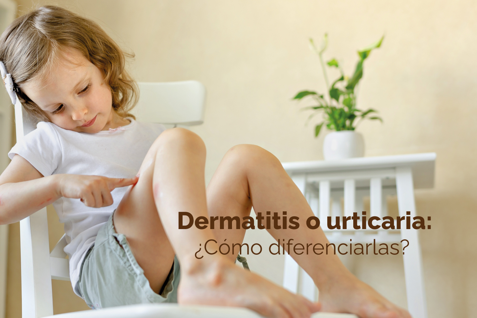 Dermatitis Urticaria