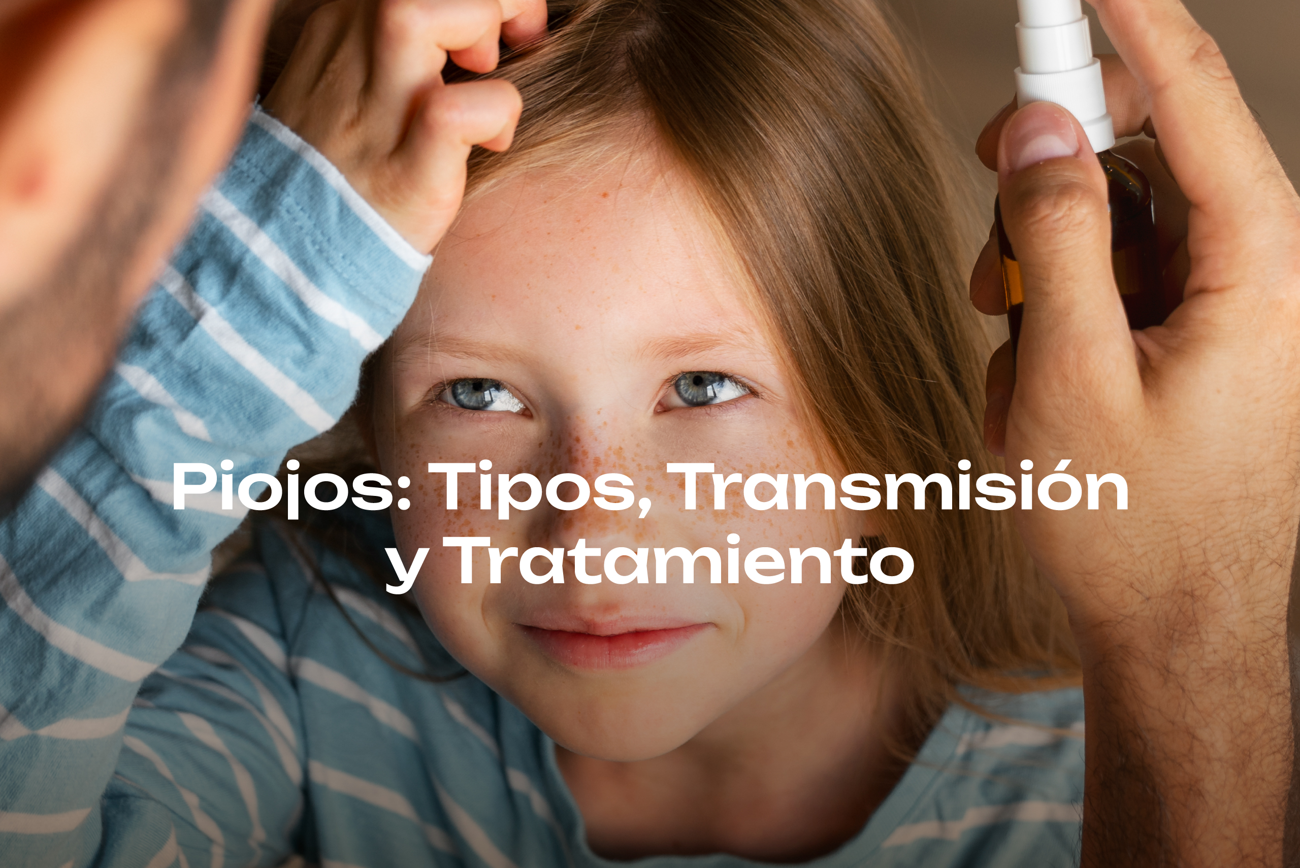 piojos y su tratamiento