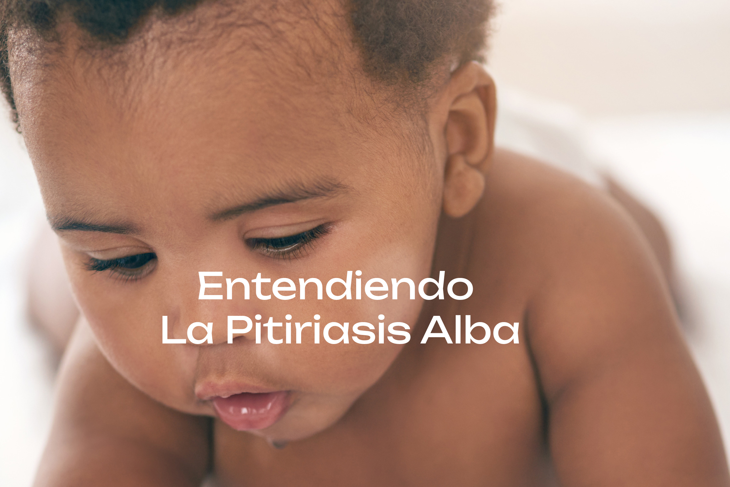 PITIRIASIS ALBA